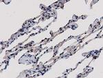 SULT1A1 Antibody in Immunohistochemistry (Paraffin) (IHC (P))