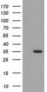 SULT1A1 Antibody in Western Blot (WB)