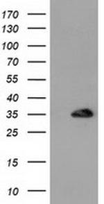 SULT1A1 Antibody in Western Blot (WB)