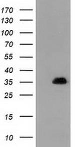 SULT1A1 Antibody in Western Blot (WB)