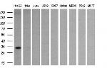 SULT1A1 Antibody in Western Blot (WB)