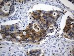 SULT1A3 Antibody in Immunohistochemistry (Paraffin) (IHC (P))