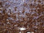 SULT1A3 Antibody in Immunohistochemistry (Paraffin) (IHC (P))