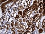 SULT1A3 Antibody in Immunohistochemistry (Paraffin) (IHC (P))