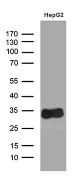 SULT1A3 Antibody in Western Blot (WB)