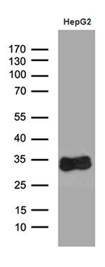 SULT1A3 Antibody in Western Blot (WB)