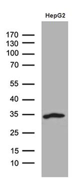 SULT1A3 Antibody in Western Blot (WB)