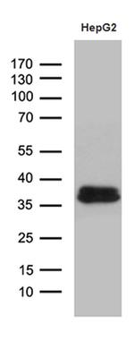 SULT1A3 Antibody in Western Blot (WB)