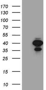 SULT1A3 Antibody in Western Blot (WB)