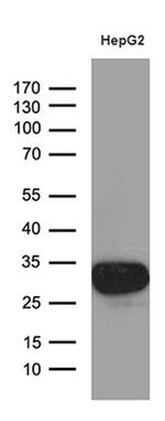 SULT1A3 Antibody in Western Blot (WB)