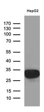 SULT1A3 Antibody in Western Blot (WB)