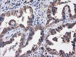 SULT1C2 Antibody in Immunohistochemistry (Paraffin) (IHC (P))