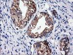 SULT1C2 Antibody in Immunohistochemistry (Paraffin) (IHC (P))