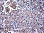 SULT1C2 Antibody in Immunohistochemistry (Paraffin) (IHC (P))