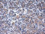 SULT1C2 Antibody in Immunohistochemistry (Paraffin) (IHC (P))