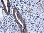 SULT1C2 Antibody in Immunohistochemistry (Paraffin) (IHC (P))