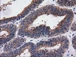 SULT1C2 Antibody in Immunohistochemistry (Paraffin) (IHC (P))