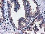 SULT1C2 Antibody in Immunohistochemistry (Paraffin) (IHC (P))
