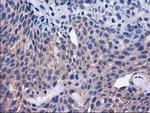 SULT1C2 Antibody in Immunohistochemistry (Paraffin) (IHC (P))