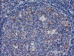 SULT1C2 Antibody in Immunohistochemistry (Paraffin) (IHC (P))