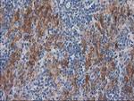 SULT1C2 Antibody in Immunohistochemistry (Paraffin) (IHC (P))