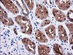 SULT1C2 Antibody in Immunohistochemistry (Paraffin) (IHC (P))