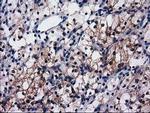 SULT1C2 Antibody in Immunohistochemistry (Paraffin) (IHC (P))