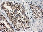 SULT1C2 Antibody in Immunohistochemistry (Paraffin) (IHC (P))