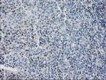 SULT1C2 Antibody in Immunohistochemistry (Paraffin) (IHC (P))