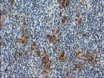 SULT1C2 Antibody in Immunohistochemistry (Paraffin) (IHC (P))