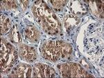 SULT1C2 Antibody in Immunohistochemistry (Paraffin) (IHC (P))