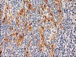 SULT1C2 Antibody in Immunohistochemistry (Paraffin) (IHC (P))