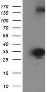 SULT1C2 Antibody in Western Blot (WB)