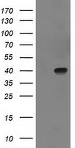 SULT1C2 Antibody in Western Blot (WB)