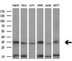 SULT1C2 Antibody in Western Blot (WB)