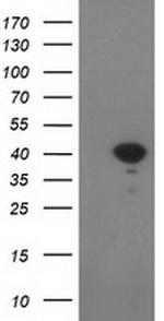 SULT1C2 Antibody in Western Blot (WB)