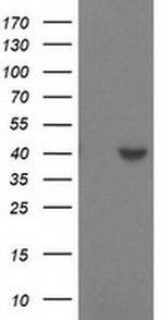 SULT1C2 Antibody in Western Blot (WB)