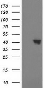 SULT1C2 Antibody in Western Blot (WB)