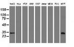 SULT2A1 Antibody in Western Blot (WB)