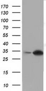 SULT2A1 Antibody in Western Blot (WB)