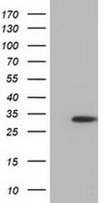 SULT2A1 Antibody in Western Blot (WB)