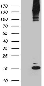 SUMO1 Antibody in Western Blot (WB)