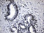 SUPT16H Antibody in Immunohistochemistry (Paraffin) (IHC (P))