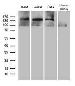 SUPT16H Antibody in Western Blot (WB)