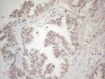 SUPT3H Antibody in Immunohistochemistry (Paraffin) (IHC (P))