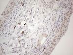 SUPT3H Antibody in Immunohistochemistry (Paraffin) (IHC (P))