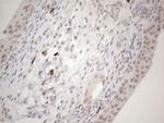 SUPT3H Antibody in Immunohistochemistry (Paraffin) (IHC (P))