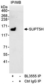 SUPT5H Antibody in Immunoprecipitation (IP)