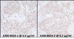 SUPT6H Antibody in Immunohistochemistry (IHC)