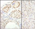 SUPT6H Antibody in Immunohistochemistry (IHC)